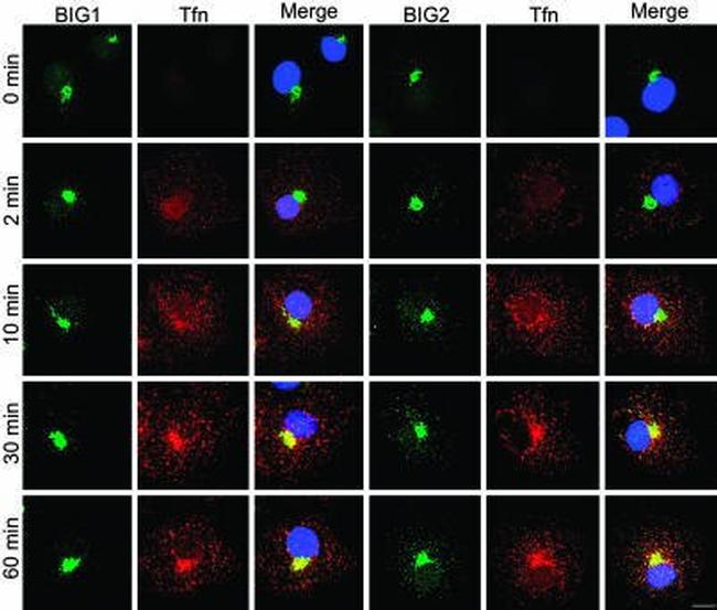 Alexa Fluor 488 Antibody in Immunocytochemistry (ICC/IF)