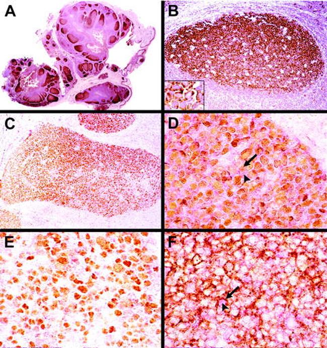 HGAL Antibody in Immunohistochemistry (IHC)