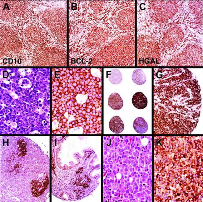 HGAL Antibody in Immunohistochemistry (IHC)