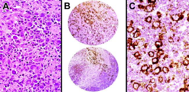 HGAL Antibody in Immunohistochemistry (IHC)