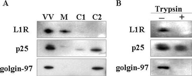 Golgin-97 Antibody in Western Blot (WB)