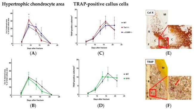 Collagen X Antibody in Immunohistochemistry (IHC)