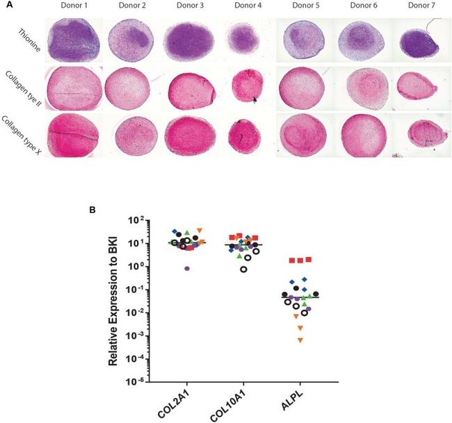 Collagen X Antibody in Immunohistochemistry (IHC)