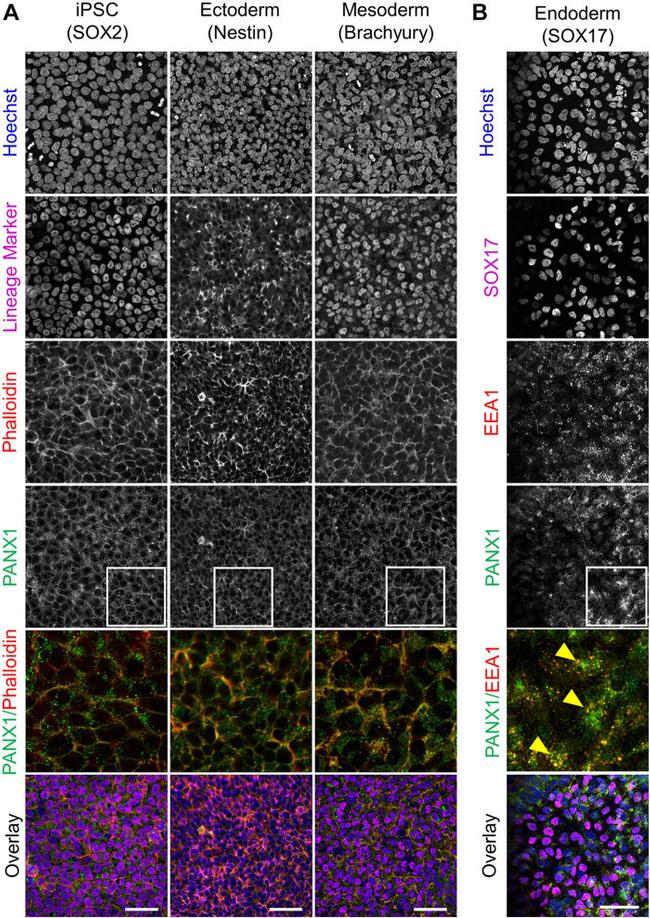 Nestin Antibody in Immunocytochemistry (ICC/IF)