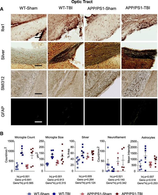 GFAP Antibody in Immunohistochemistry (IHC)