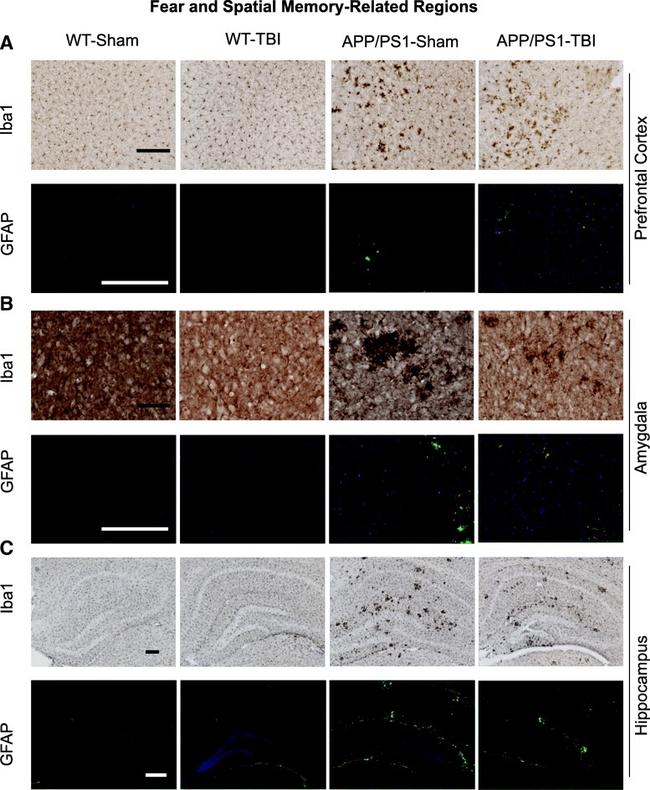 GFAP Antibody in Immunohistochemistry (IHC)