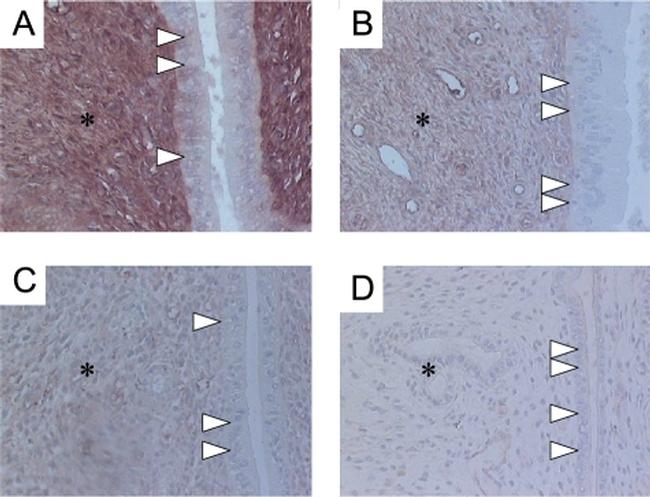 Estrogen Receptor beta Antibody in Immunohistochemistry (IHC)