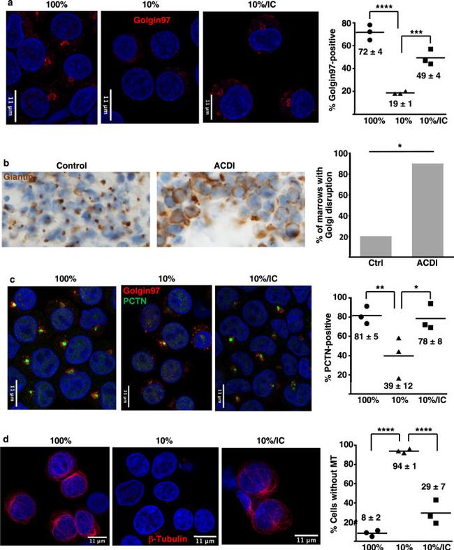 Golgin-97 Antibody in Immunocytochemistry (ICC/IF)