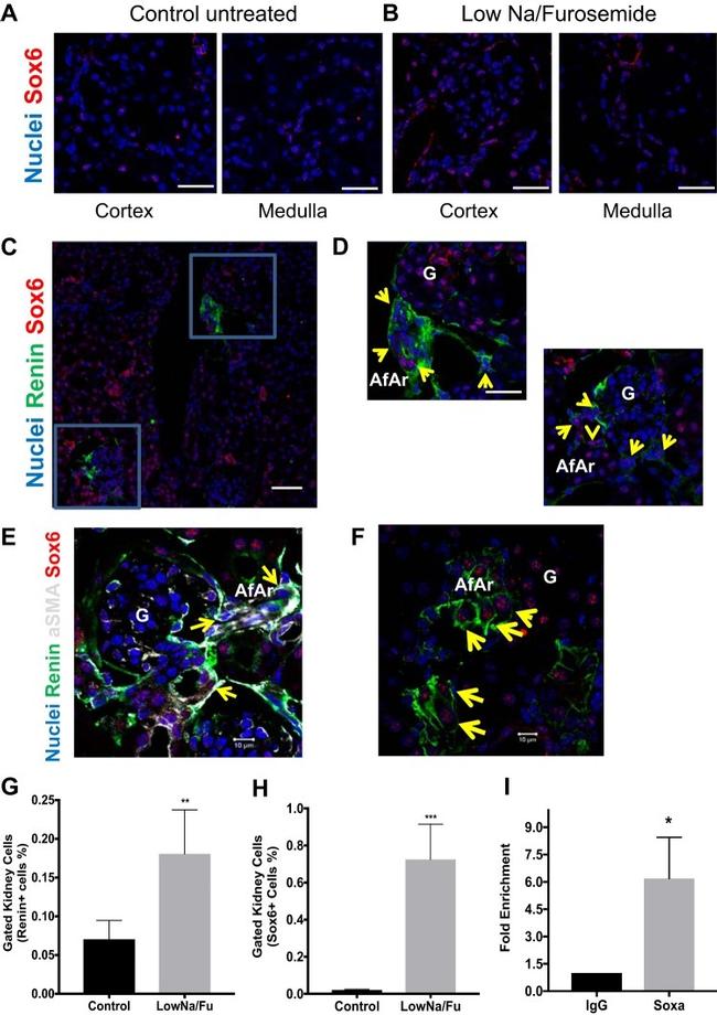 SOX6 Antibody in ChIP Assay (ChIP)