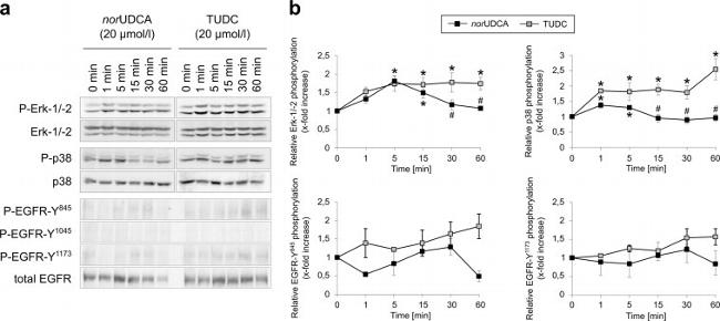 Phospho-EGFR (Tyr1173) Antibody in Western Blot (WB)