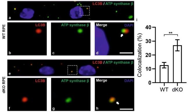 ATP Synthase beta Antibody in Immunocytochemistry (ICC/IF)