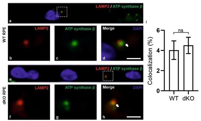 ATP Synthase beta Antibody in Immunocytochemistry (ICC/IF)