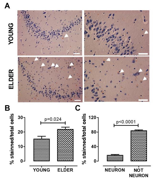 AHR Antibody in Immunohistochemistry, Immunohistochemistry (PFA fixed) (IHC, IHC (PFA))