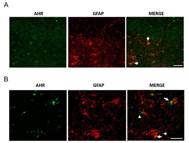 AHR Antibody in Immunocytochemistry, Immunohistochemistry (PFA fixed) (ICC/IF, IHC (PFA))