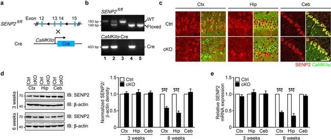 CaMKII alpha Antibody in Immunohistochemistry (IHC)