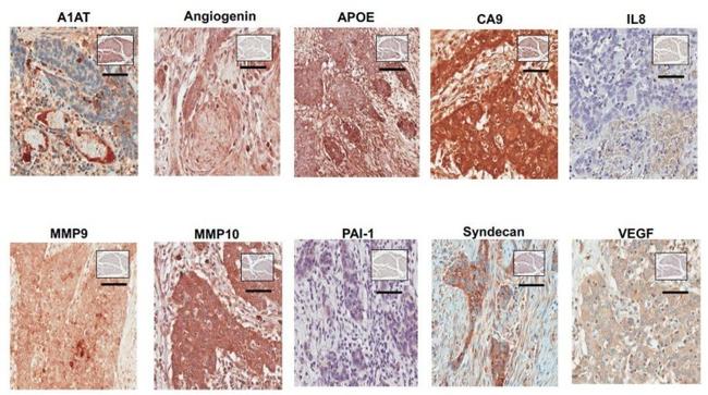 IL-8 (CXCL8) Antibody in Immunohistochemistry (IHC)