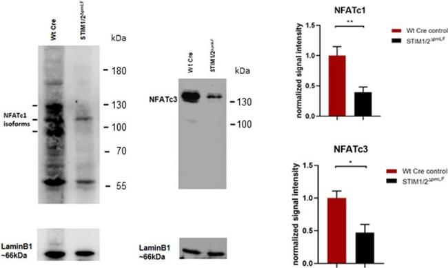 Lamin B1 Antibody in Western Blot (WB)