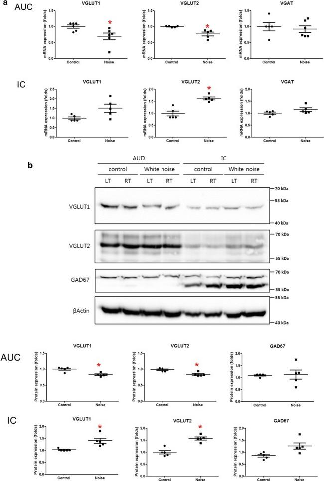 VGLUT1 Antibody in Western Blot (WB)