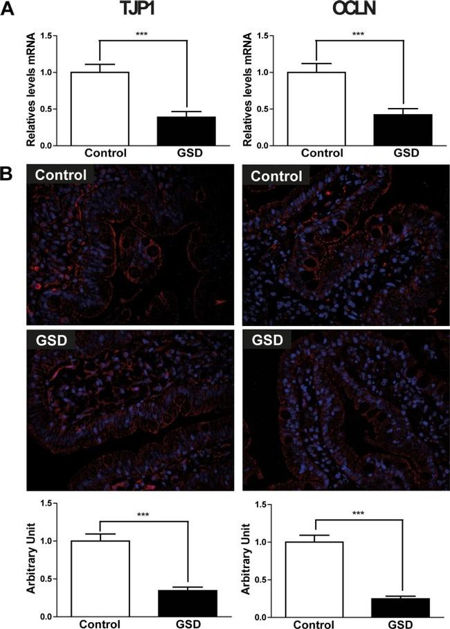 Occludin Antibody in Immunohistochemistry (IHC)