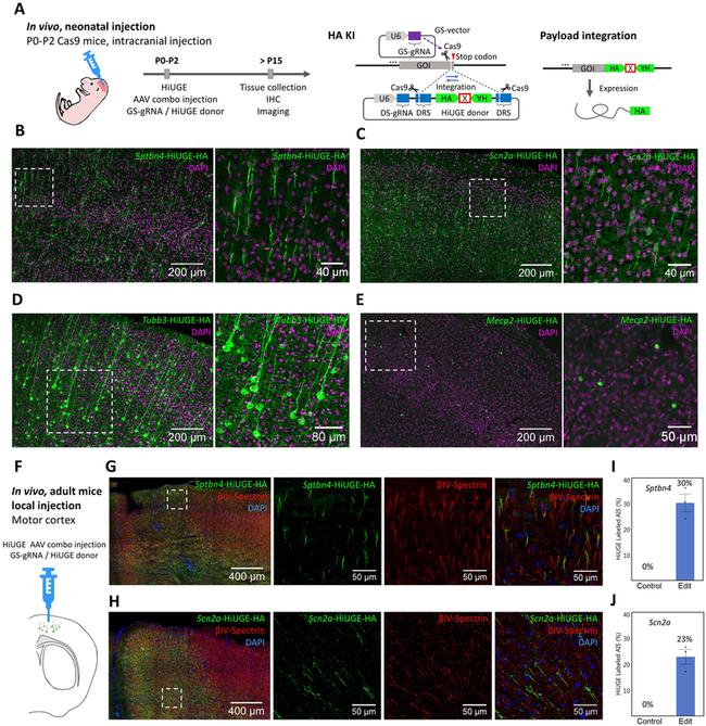 Spectrin beta-4 Antibody in Immunohistochemistry (IHC)