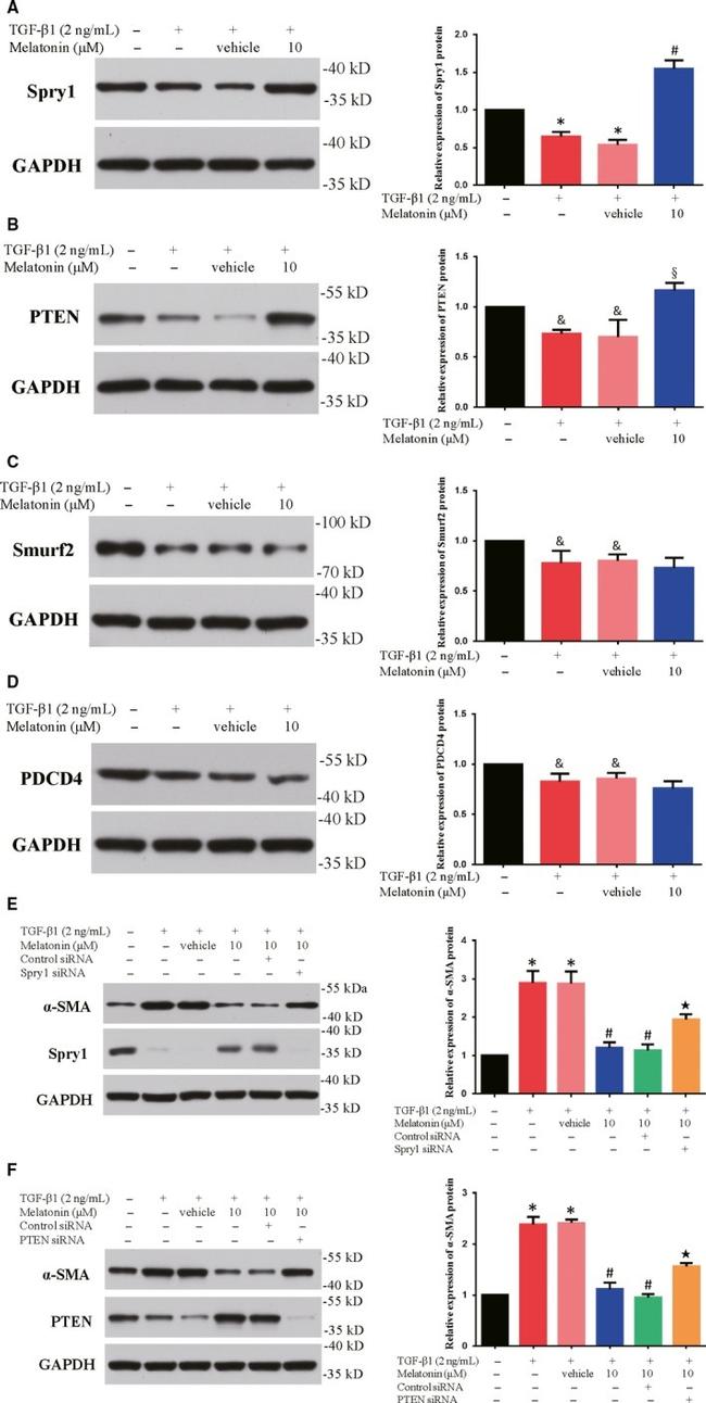 PTEN Antibody in Western Blot (WB)