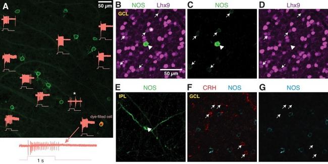 nNOS Antibody in Immunohistochemistry (IHC)