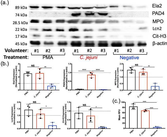 NGAL Antibody in Western Blot (WB)