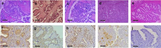 MMP2 Antibody in Immunohistochemistry (IHC)