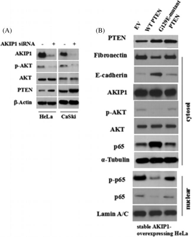 Phospho-AKT1 (Ser473) Antibody in Western Blot (WB)