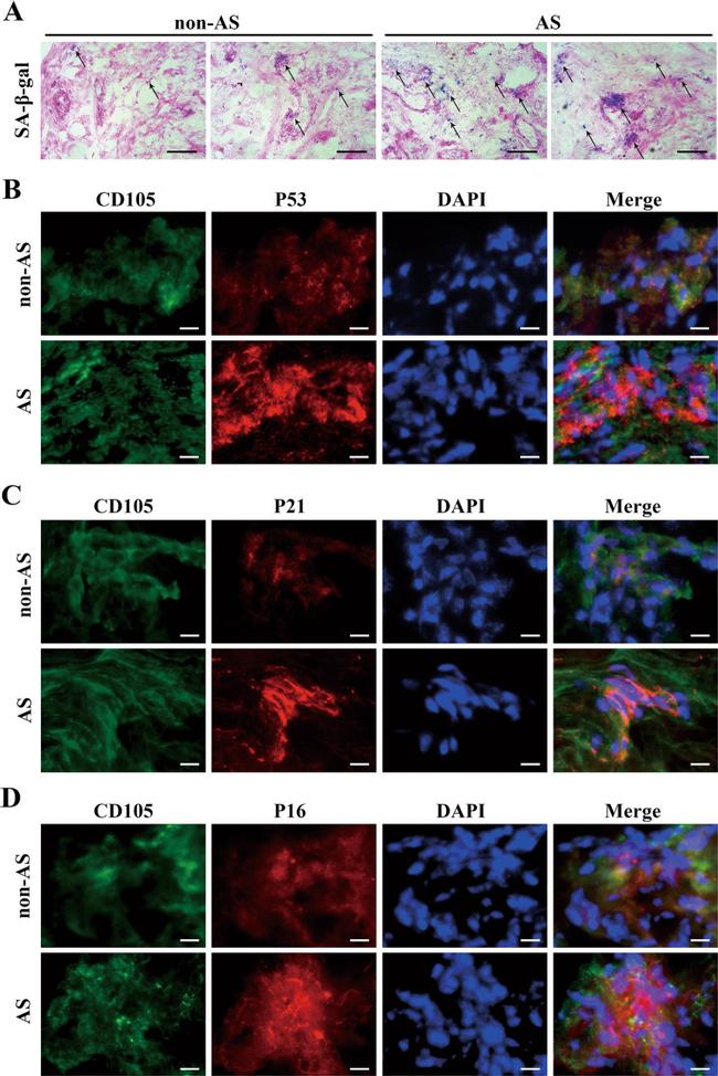 p21 Antibody in Immunocytochemistry (ICC/IF)