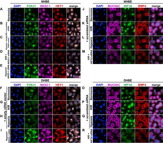 BMP-4 Antibody in Immunocytochemistry (ICC/IF)