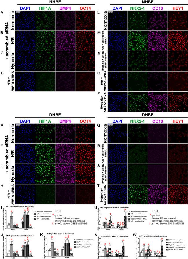 BMP-4 Antibody in Immunocytochemistry (ICC/IF)