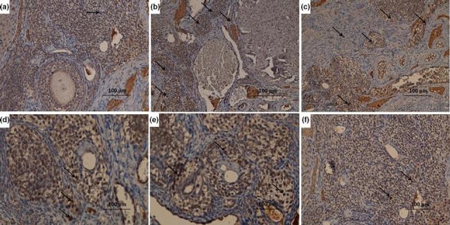 NFkB p50/p105 Antibody in Immunohistochemistry (IHC)