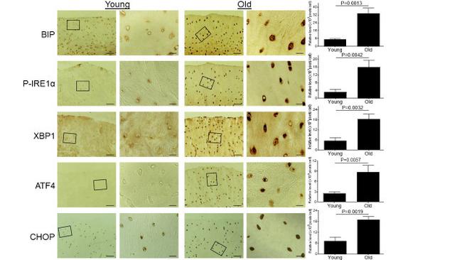 Phospho-IRE1 alpha (Ser724) Antibody in Immunohistochemistry (Paraffin) (IHC (P))