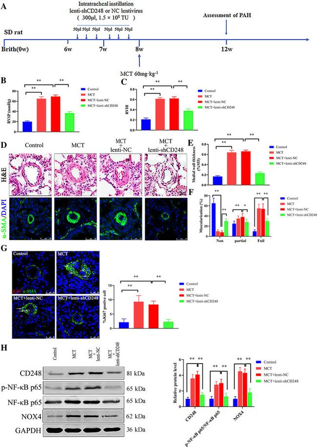 Alpha-Smooth Muscle Actin Antibody in Immunocytochemistry (ICC/IF)