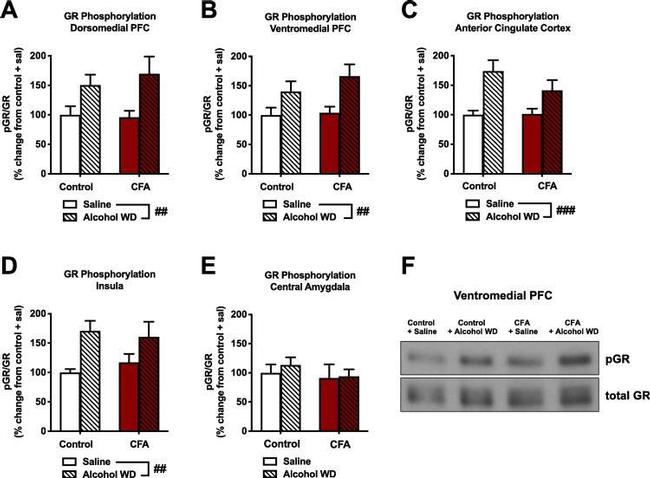 Glucocorticoid Receptor Antibody in Western Blot (WB)