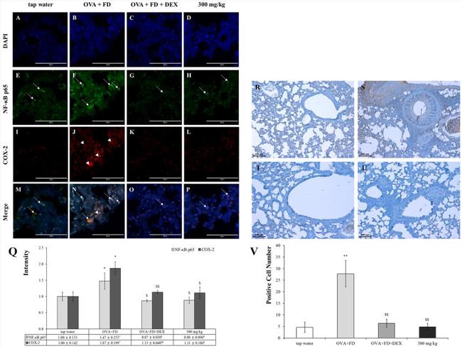 COX2 Antibody in Immunocytochemistry (ICC/IF)