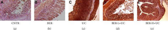 TGF beta-1 Antibody in Immunohistochemistry (IHC)