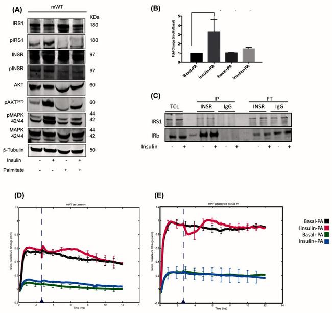 INSR beta Antibody in Western Blot, Immunoprecipitation (WB, IP)