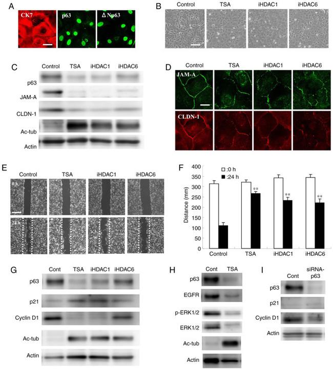 p21 Antibody in Western Blot (WB)