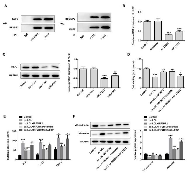 KLF2 Antibody in Immunoprecipitation (IP)