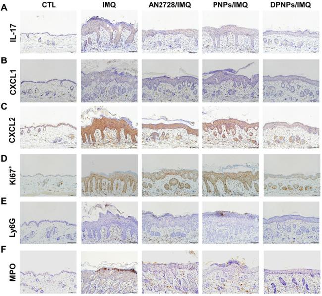 CXCL1 Antibody in Immunohistochemistry (IHC)