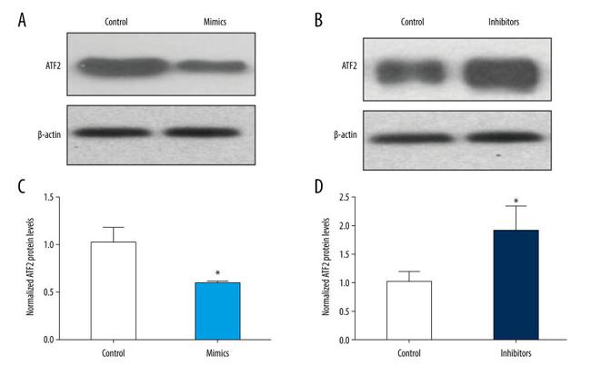 ATF2 Antibody in Western Blot (WB)