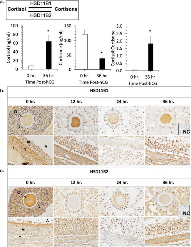 HSD11B2 Antibody in Immunohistochemistry (IHC)