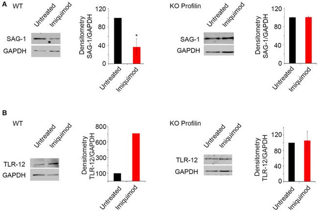 TLR12 Antibody in Western Blot (WB)