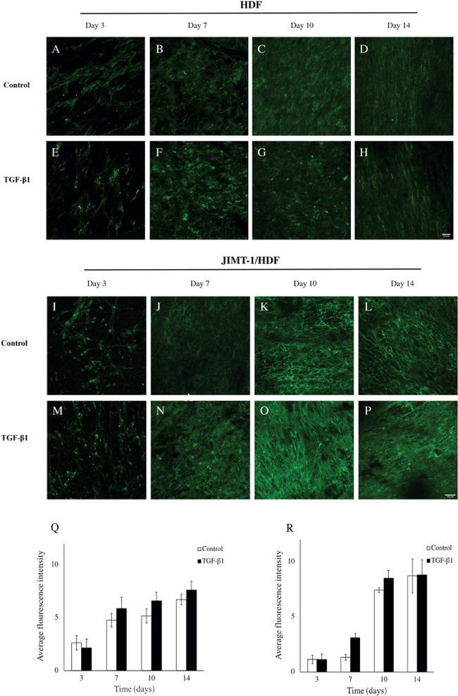 Collagen I Antibody in Immunocytochemistry (ICC/IF)