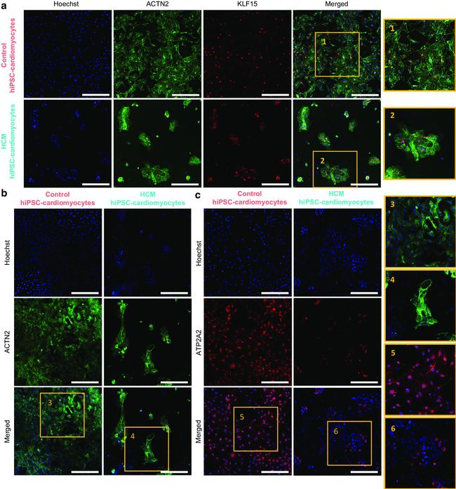 SERCA2 ATPase Antibody in Immunocytochemistry (ICC/IF)