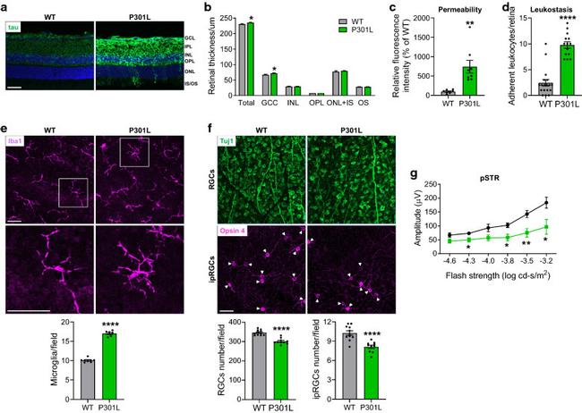 Opsin 4 Antibody in Immunocytochemistry (ICC/IF)