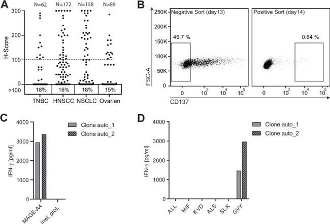 MAGEA4 Antibody in Immunohistochemistry (IHC)