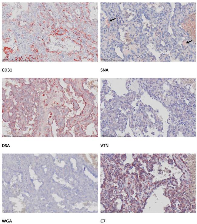 Vitronectin Antibody in Immunohistochemistry (IHC)